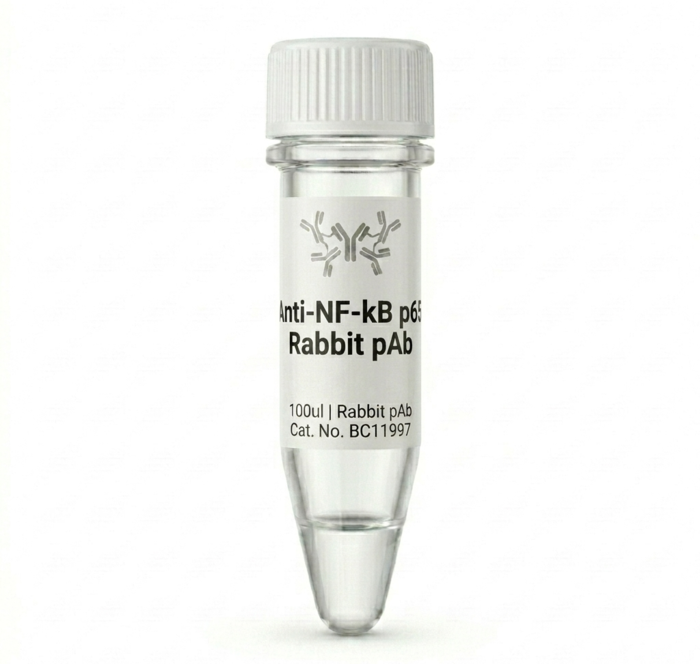 Anti-NF-kB p65 Rabbit Polyclonal Antibody 100ul