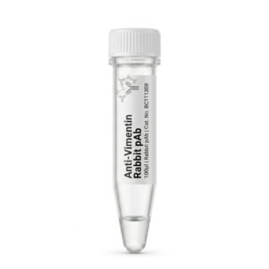 Anti-Vimentin Rabbit Polyclonal Antibody 100ul BC111308