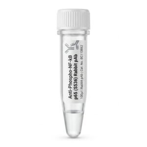 Anti-Phospho-NF-kB p65 (S536) Rabbit Polyclonal Antibody