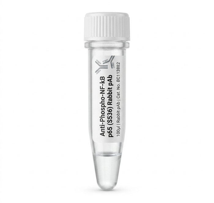 Anti-Phospho-NF-kB p65 (S536) Rabbit Polyclonal Antibody