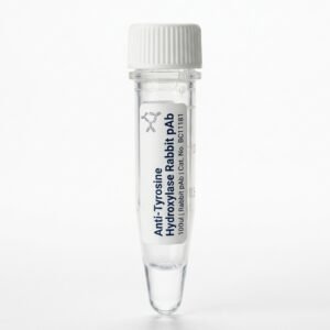 Anti-Tyrosine Hydroxylase Rabbit pAb 100ul (BC11181)