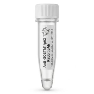Anti-SQSTM1/p62 Rabbit Polyclonal Antibody 100ul