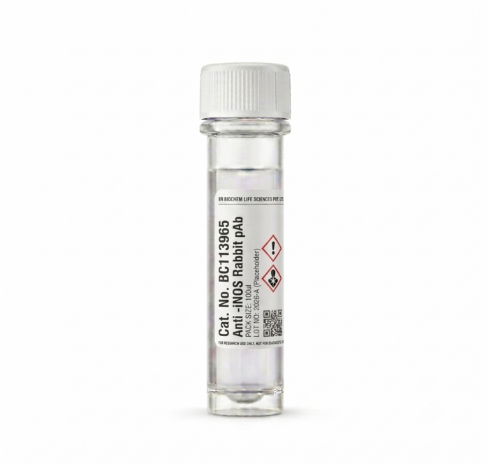 Anti-iNOS Rabbit Polyclonal Antibody 100ul