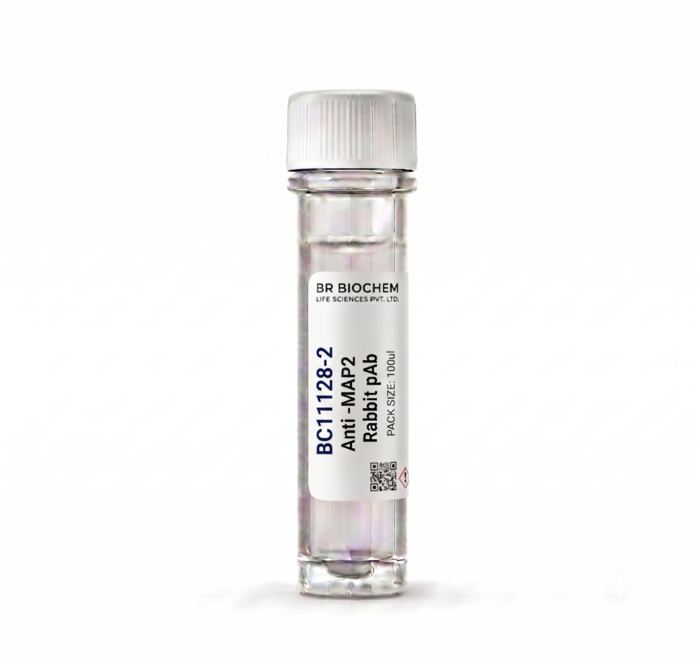 Anti-MAP2 Rabbit Polyclonal Antibody 100ul BC11128-2